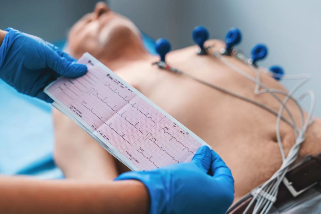 Exame de Eletrocardiograma: O que é e para que serve?